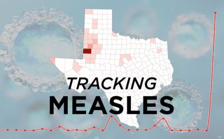 পশ্চিম টেক্সাসে মিজলসের ভয়াবহ প্রাদুর্ভাব: আক্রান্ত শতাধিক, মৃত্যু শিশুর