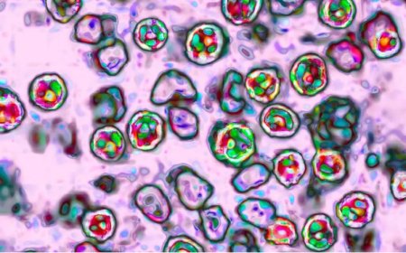 রকওয়াল কাউন্টিতে একই পরিবারের ৫ শিশুর হাম