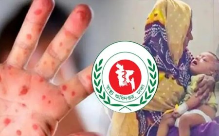 হাম ও হামের উপসর্গে আরও ১৭ শিশুর মৃত্যু